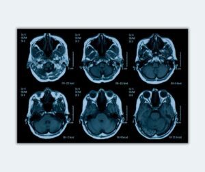 The Truths and Myths of Pornography Brain Research - Ever Accountable